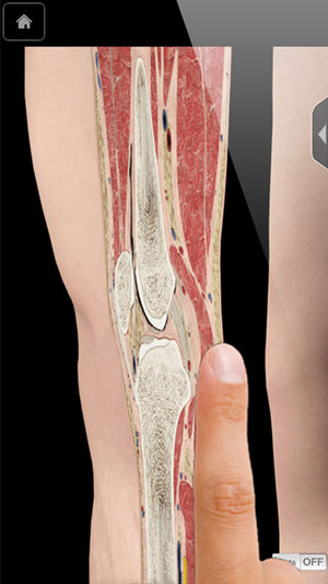 Knee Pro III with Animations - iPhone Edition